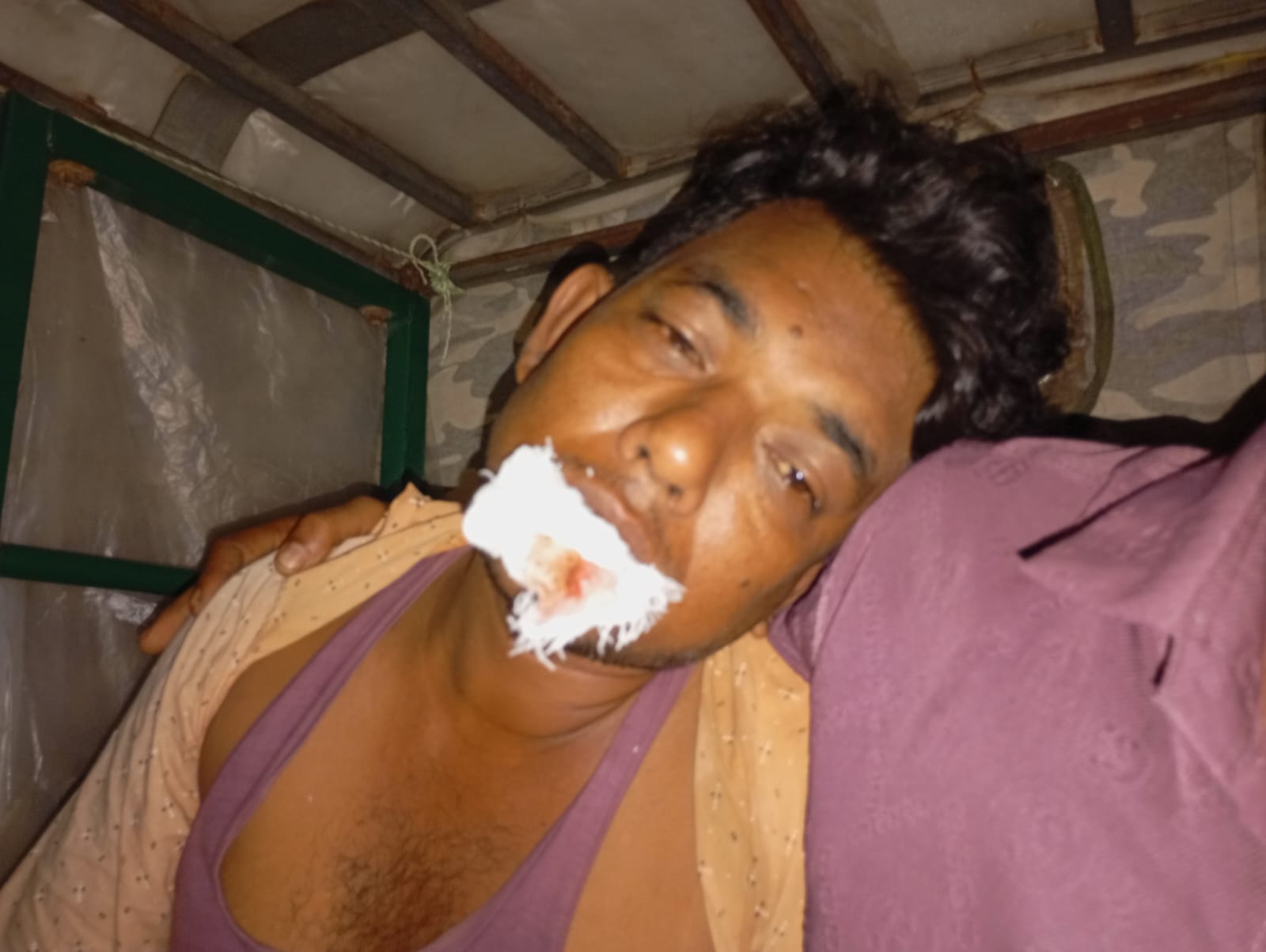কক্সবাজারের উখিয়ায় ১৪৪ ধারা ভঙ্গ করে মেরে রক্তাক্ত করলো জসিম উদ্দিনকে---